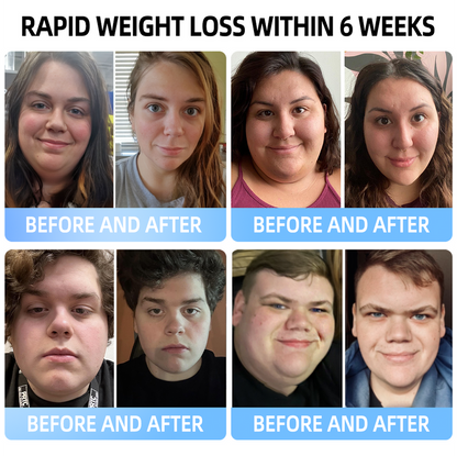 [See results in 7 days🔥]🇺🇸Croaie® SMGT-GLP-1 Nano Microneedle Patch（Painless, long-lasting, addressing diabetes, obesity, and cardiovascular diseases)