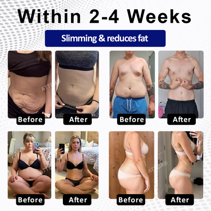 🔥[See results in 7 days🔥]Croaie® GlycoFit SMGT-GLP-1 NanoDart Patches