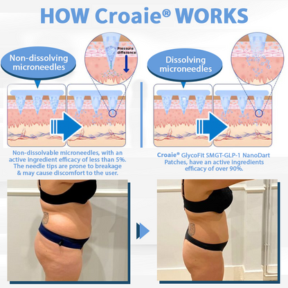 🔥[See results in 7 days🔥]Croaie® GlycoFit SMGT-GLP-1 NanoDart Patches