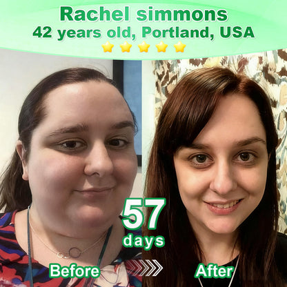 𝐃𝗼𝗰𝐭𝗼𝗿 𝗥𝗲𝐜𝗼𝗺𝗺𝐞𝗻𝗱𝐞𝗱👩‍⚕️| 𝙇𝒐𝒕𝐦𝒂𝘆®  𝑮𝗟𝑷-1 𝟔-𝗶𝙣-𝟏 𝙊𝙧𝒂𝙡 𝗔𝙢𝙥𝙤𝙪𝙡𝙚𝒔 | 🌟 Backed by science | 6-in-1 formula | Results in 7 days 🤝