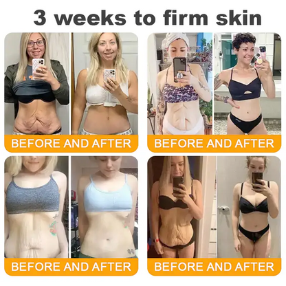 Made and Shipped from USA ✨ TLOPA® Bee Venom Skin Restoration Cream ⏰ LAST DAY 80% OFF💥💥