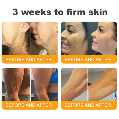 Made and Shipped from USA ✨ TLOPA® Bee Venom Skin Restoration Cream ⏰ LAST DAY 80% OFF💥💥