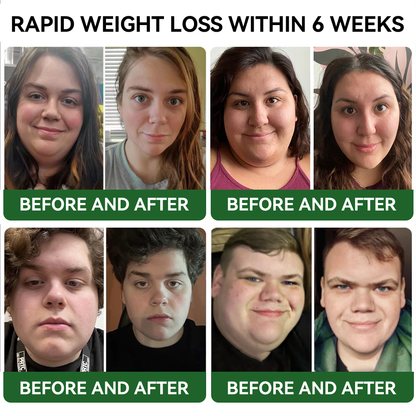 𝐓𝐋𝐎𝐏𝐀® 𝐆𝐋𝐏-𝟏 𝐒𝐥𝐢𝐦𝐦𝐢𝐧𝐠 & 𝐇𝐞𝐚𝐥𝐭𝐡 𝐁𝐨𝐨𝐬𝐭 𝐃𝐫𝐨𝐩𝐬 (𝐅𝐨𝐨𝐝-𝐠𝐫𝐚𝐝𝐞 𝐅𝐚𝐭 𝐁𝐮𝐫𝐧𝐞𝐫)🔥