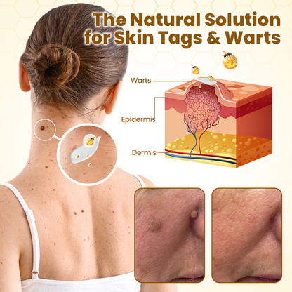 Made and Shipped from USA ✨ 𝗧𝗟𝗢𝗣𝗔® Bee Venom Skin Restoration Cream ⏰